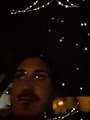 Lupus_3
